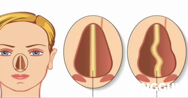 Terowongan Aroma: Rahasia Merawat Hidung agar Tetap Sehat dan Bersinar